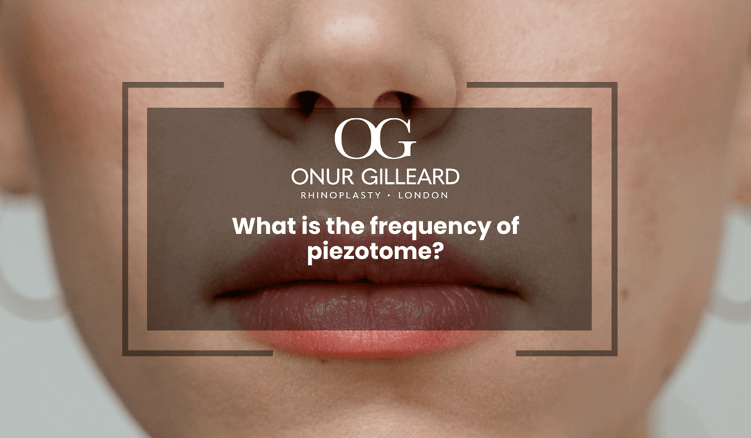 What is the frequency of piezotome?