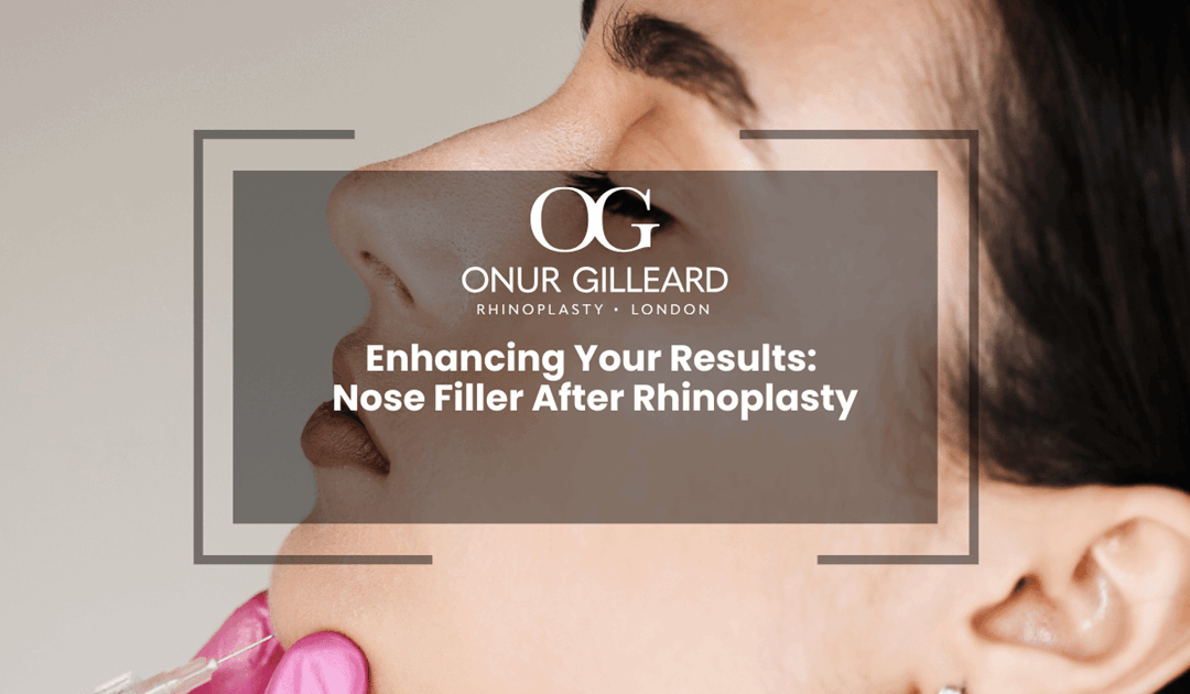 Enhancing Your Results: Nose Filler After Rhinoplasty