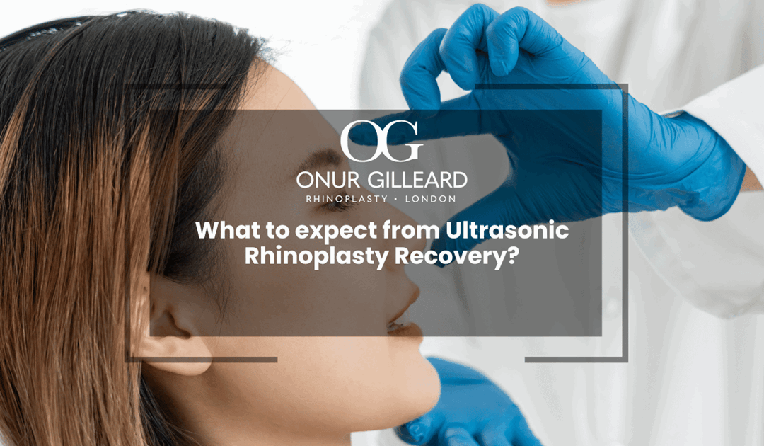 What to expect from Ultrasonic Rhinoplasty Recovery