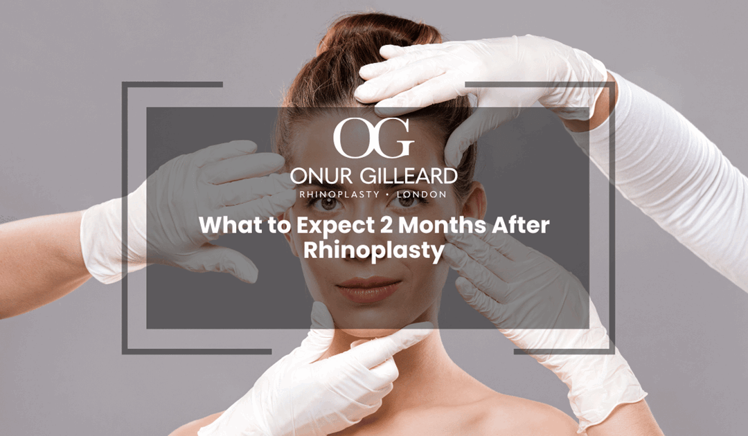 What to Expect 2 Months After Rhinoplasty