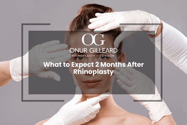 What to Expect 2 Months After Rhinoplasty
